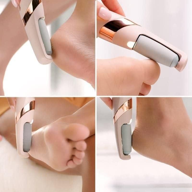 Electric Cordless Callus Remover: Your At-Home Pedicure Solution
